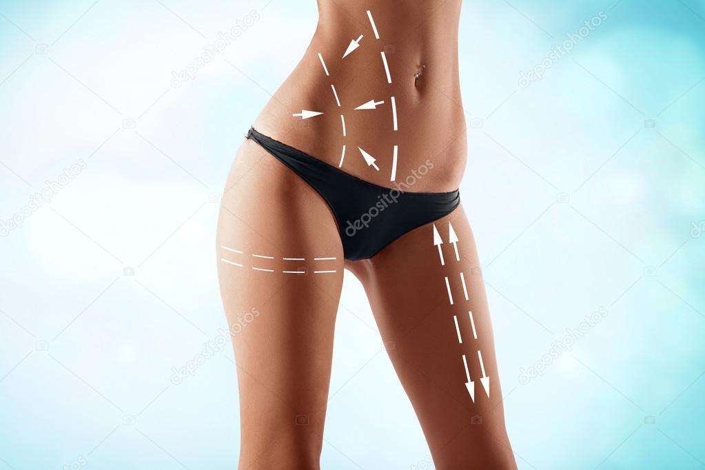 fit female body with the drawing arrows. Plastic surgery, health