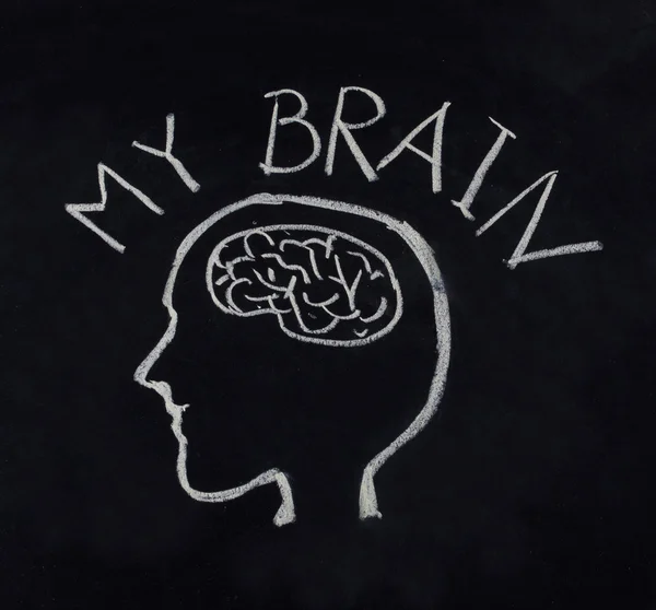 Menselijk brein in idee concept — Stockfoto