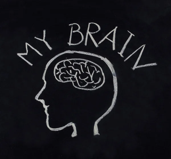 Tdah Sur Le Cerveau Image Libre De Droit Par Thinglass C