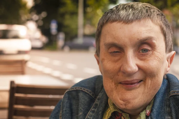 Uomo disabile seduto in un caffè all'aperto — Foto Stock