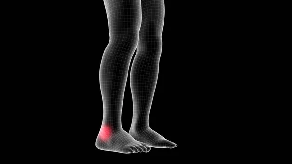 Ілюстрація Чоловічої Рентгенівської Голограми Показує Ділянку Болю Ділянці Ноги — стокове фото