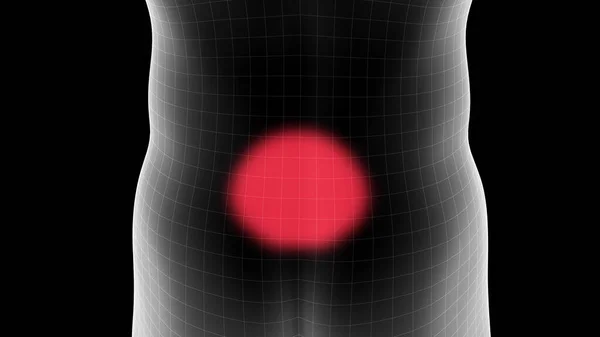 Bacak Bölgesinde Ağrı Alanı Gösteren Bir Adamın Röntgen Görüntüsü — Stok fotoğraf