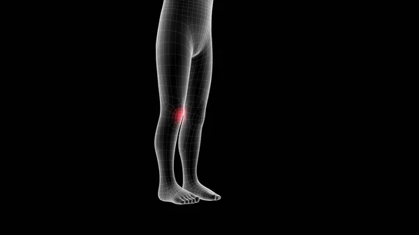 Illustration Children Xray Hologram Showing Pain Area Leg Area — Stock Photo, Image