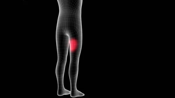 儿童X光全息图3D图 显示腿部痛处 — 图库照片