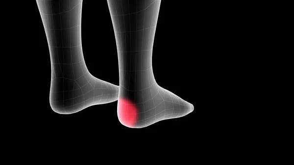 脚部の痛みを示す小児X線ホログラムの3Dイラスト ロイヤリティフリーのストック画像