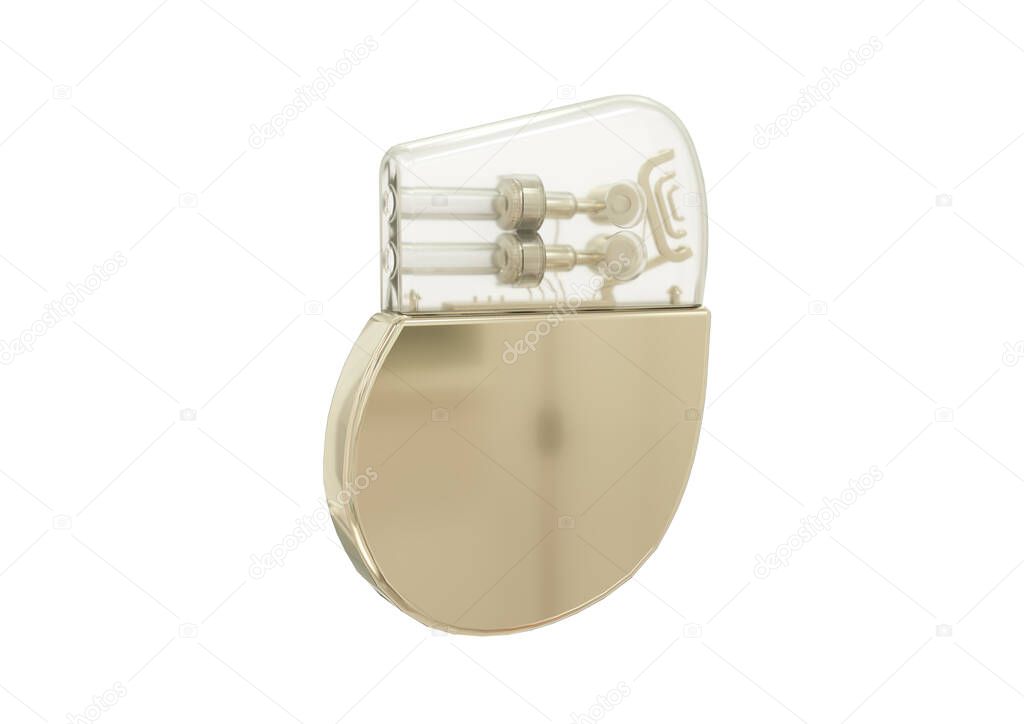 Marcapasos cardíaco artificial aislado sobre fondo blanco. Renderizado