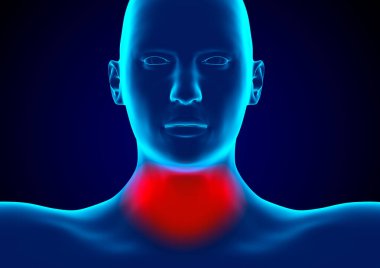 Farenjit, Streptococcus familyasından bakterilerin neden olduğu bir gırtlak enfeksiyonudur. 3B görüntüleme