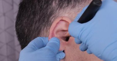 Tıbbi bir aletle erkek bir hastanın kulağından kulak kirini alan bir doktorun yakın çekimi. ENT bakımı, hijyen ve profesyonel sağlık prosedürü kavramı.