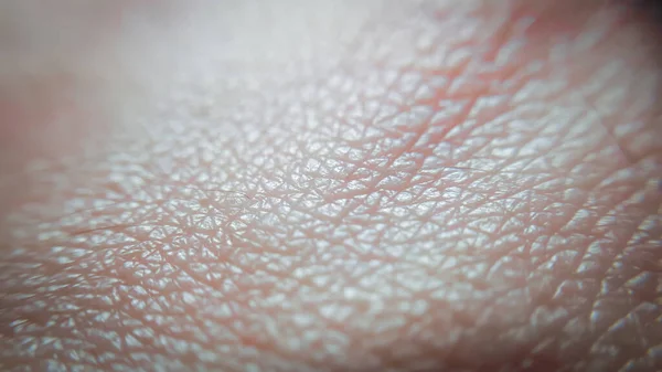 Bőrkéz Közelsége Makrorészletek Bőrgyógyászati Textúra — Stock Fotó