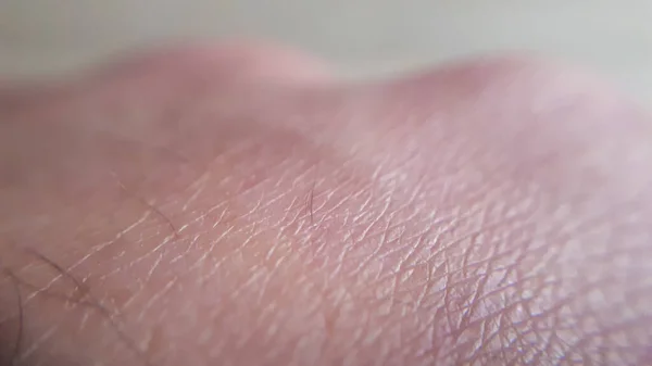 Macro Pele Mão Humana Conceito Medicina Dermatologia Detalhes Textura Pele — Fotografia de Stock