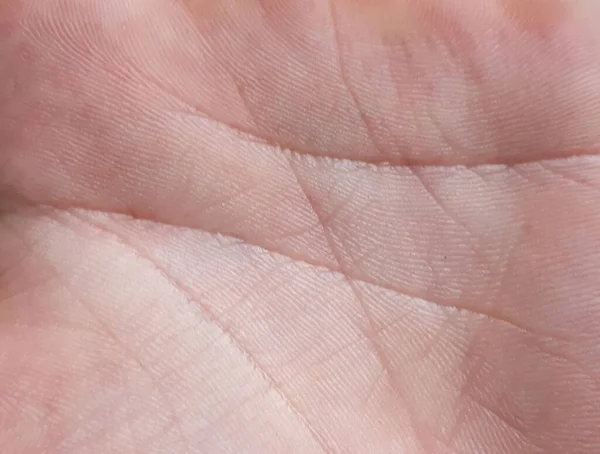 Makroskóra Ludzkiej Ręki Medycyna Dermatologia Szczegóły Dotyczące Struktury Skóry Ludzkiej — Zdjęcie stockowe