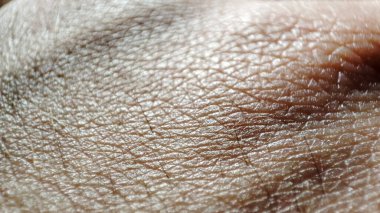 İnsan elinin makro derisi. Tıp ve dermatoloji konsepti. Sağlıklı kahverengi Kafkas derisi. Arkaplan için cilt detaylarını kapat