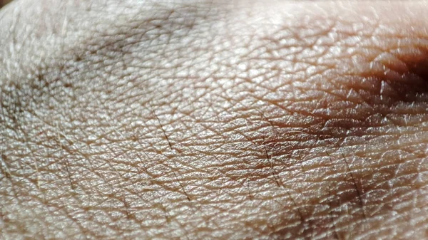 Makrohaut Der Menschlichen Hand Medizin Und Dermatologie Gesunde Braune Kaukasische — Stockfoto