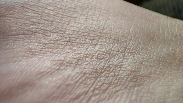 Dermatologie Konzept Details Zum Hintergrund Der Menschlichen Haut Hautdermatitis Aus — Stockfoto