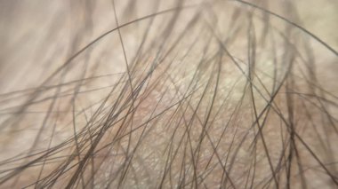 Makro görüntüde insan derisinin dokusunu ve detaylarını aydınlatan ince saç telleri görülüyor. Güzellik ya da cilt bakımı için uygundur.