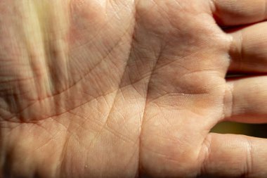 Güneş ışığıyla aydınlatılan detaylı deri dokusuna sahip bir insan elinin yakın çekimi. Görüntü, bir elin benzersiz özelliklerini yakalıyor. Bireysel çizgiler ve desenler sergiliyor..