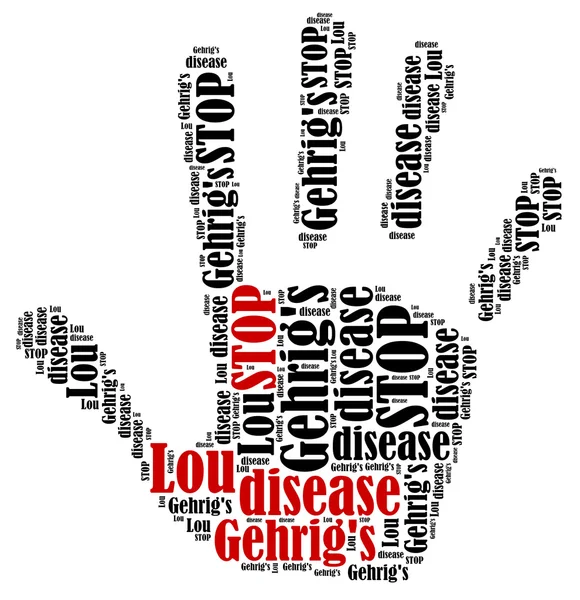 ALS. Word cloud illustration brain disease related. — Stock Photo, Image