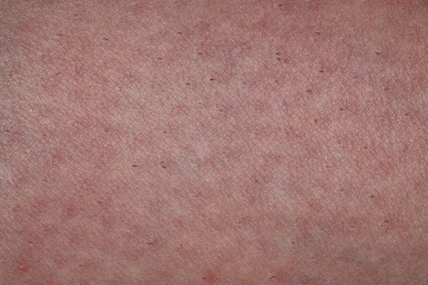Υφή του δέρματος του ανθρώπου — Φωτογραφία Αρχείου