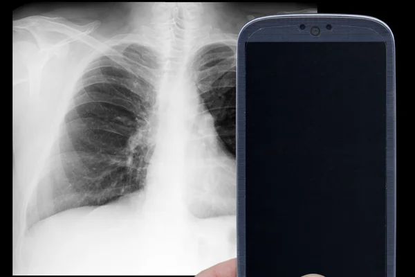 Smartphone x-ray — Zdjęcie stockowe