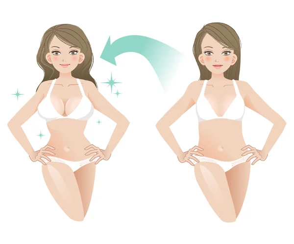 Mujer hermosa antes y después de la cirugía estética — Vector de stock