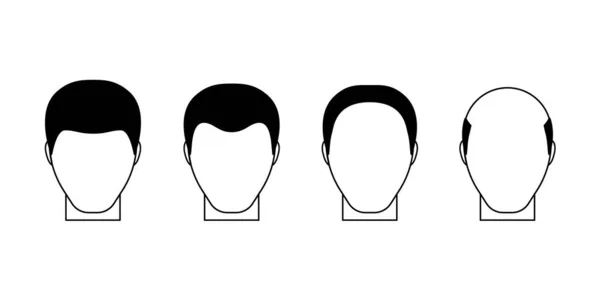 男性秃顶阶段 男性的头发脱落问题 头发掉了矢量平面插图 — 图库矢量图片