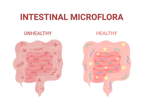 Microflora Intestinal Saudável Insalubre Boa Nutrição Intestinal Bactérias Nocivas Benéficas — Vetor de Stock