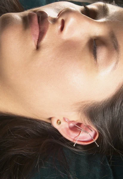 Woman with acupuncture needles in ears