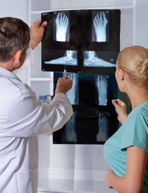 Ortopedik Doktor Röntgen ayak gösterir. valgus ayak