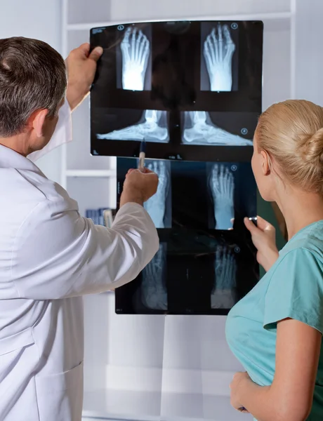 Ortopedických doktor ukazuje RTG nohy. valgus noha — Stock fotografie