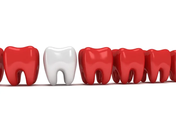 Gesunder Zahn in Reihe schmerzender Zähne — Stockfoto