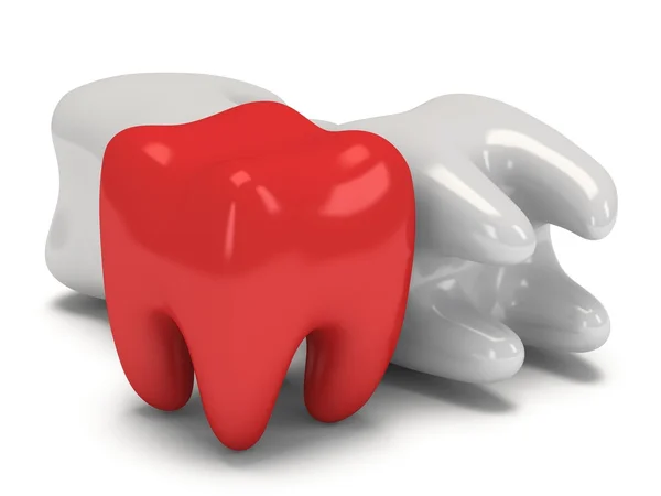 疼痛和健康的牙齿 — 图库照片