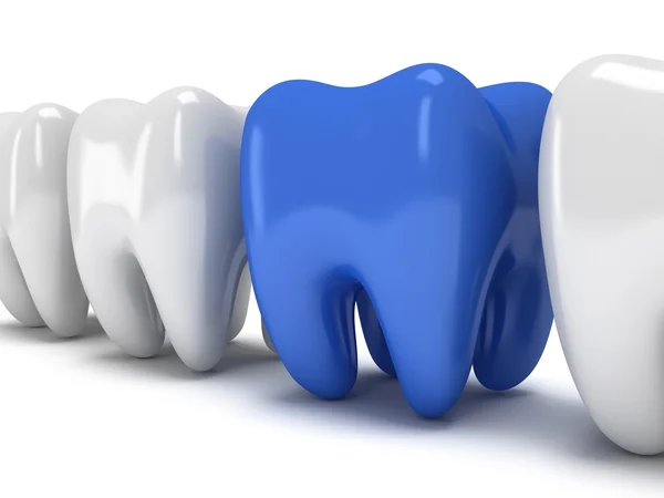 Dente dolorido em fileira de dentes saudáveis — Fotografia de Stock