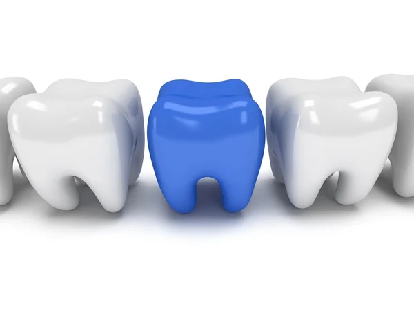 健康な歯の行に痛む歯 — ストック写真