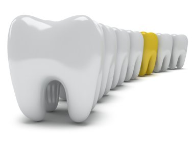 sağlıklı dişler satırındaki ağrıyan diş