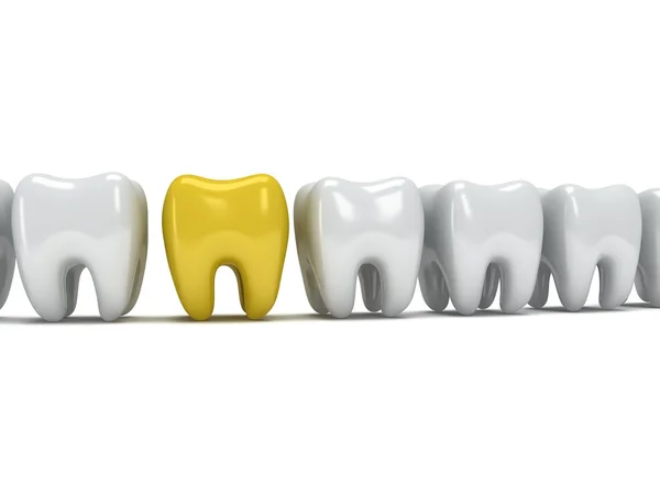 Sağlıklı dişler satırındaki ağrıyan diş — Stok fotoğraf