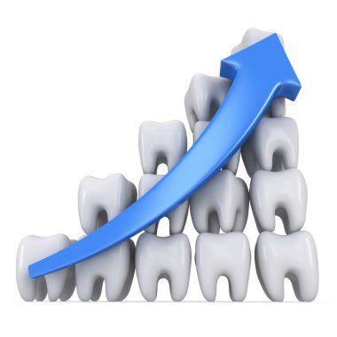 mavi ok ile 3D diş bar diyagramı