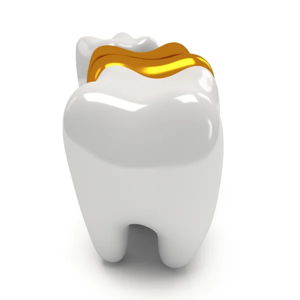 Gold and healthy teeth — Stock Photo, Image