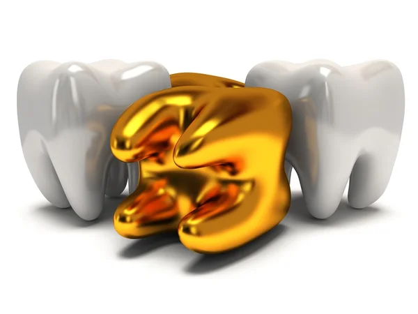 Ouro e dentes saudáveis — Fotografia de Stock