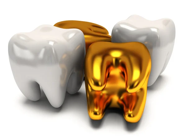 金和健康的牙齿 — 图库照片