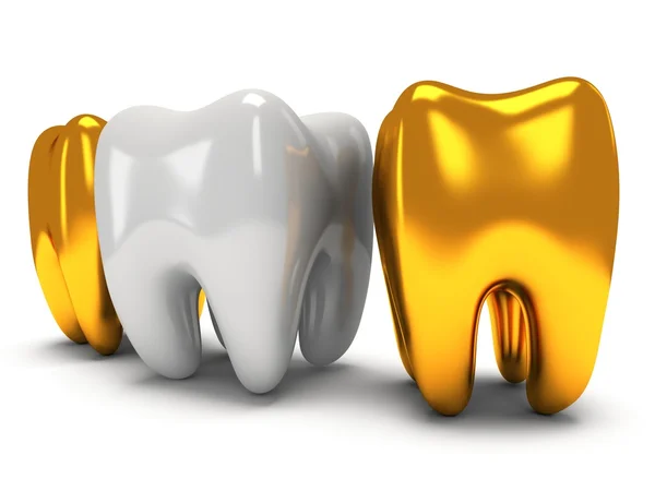 Altın ve sağlıklı dişler — Stok fotoğraf