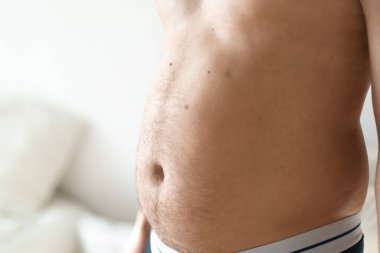 Şişman adamın karnını kapat. Obezite. Sağlık kavramı