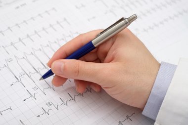 Elektrokardiyogram kağıt üzerinde bir el doktorun yakın çekim