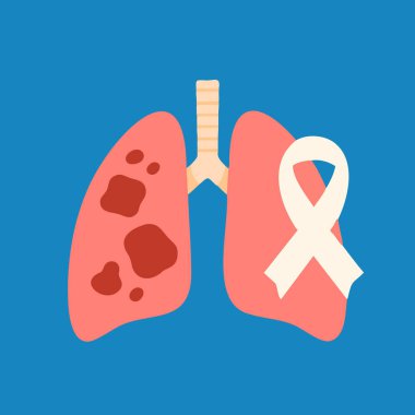 Tümör, doktor, sigara ve farkındalık kurdeleli akciğerlerin düz tıbbi çizimi. Sağlık kampanyaları, tarama, eğitim ve sigara içilmemesi için ideal.