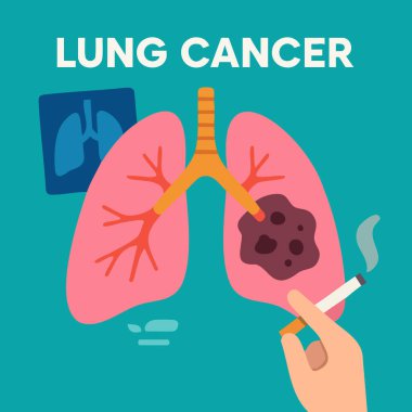 Tümör, doktor, sigara ve farkındalık kurdeleli akciğerlerin düz tıbbi çizimi. Sağlık kampanyaları, tarama, eğitim ve sigara içilmemesi için ideal.