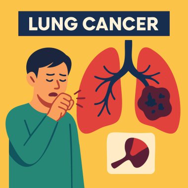 Tümör, doktor, sigara ve farkındalık kurdeleli akciğerlerin düz tıbbi çizimi. Sağlık kampanyaları, tarama, eğitim ve sigara içilmemesi için ideal.