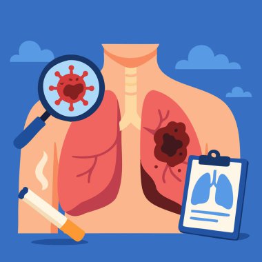 Tümör, doktor, sigara ve farkındalık kurdeleli akciğerlerin düz tıbbi çizimi. Sağlık kampanyaları, tarama, eğitim ve sigara içilmemesi için ideal.