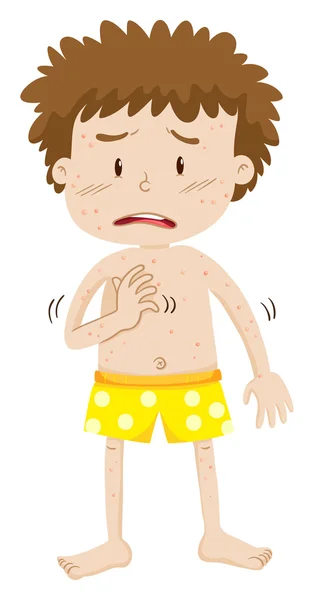 Boy with chicken pox — Stock Vector