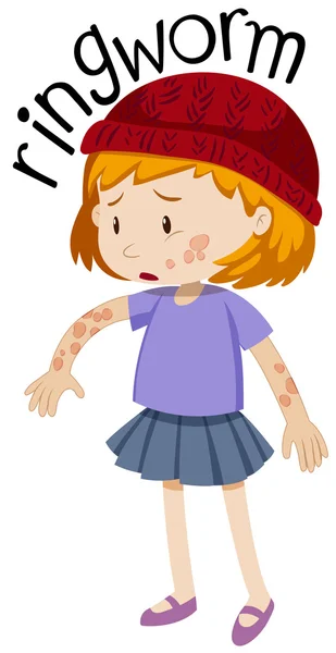 Petite fille avec teigne sur le corps — Image vectorielle