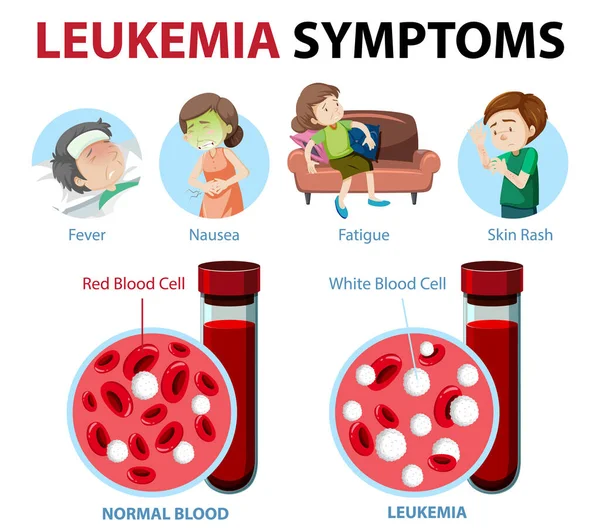 Síntomas Leucemia Ilustración Infográfica Estilo Caricatura — Vector de stock