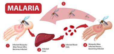 Malaria symptom information infographic illustration clipart